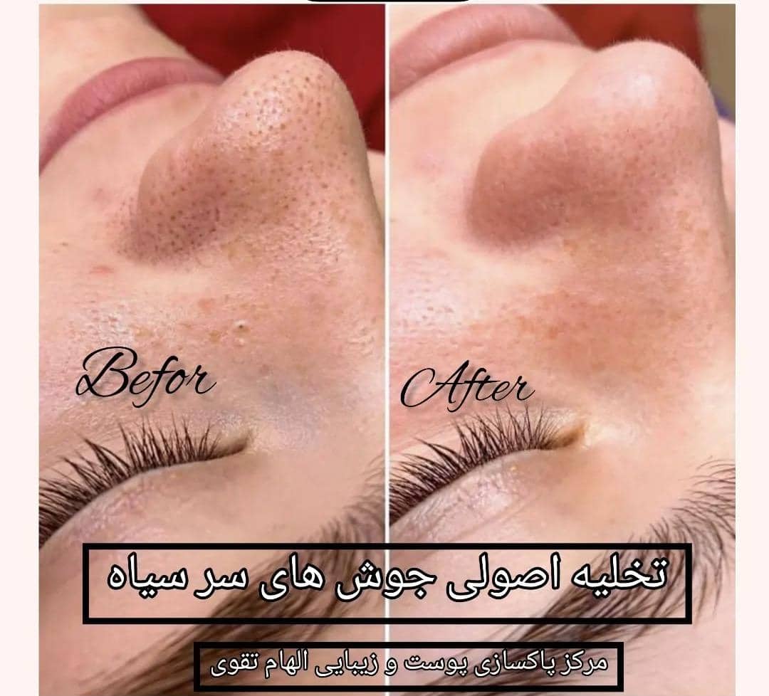 مرکز پاکسازی پوست و زیبایی الهام تقوی در امیدیه